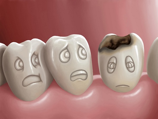 Причины кариеса молочных зубов