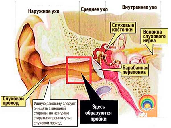 Формирование ушной пробки